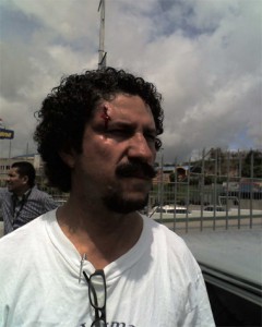  José Manuel Flores Arguijo despues de haber sido vapuleado en la represion del 30 de Julio del 2009
